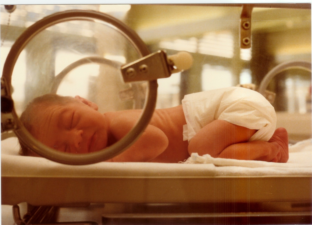 Neonatal Baby